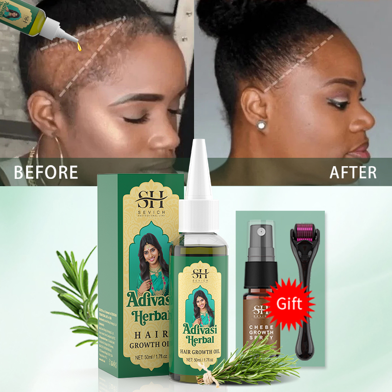 Ayurvedic Hair Growth Oil Indi - Ayurvedic & Herbal Wellness Kits recension och pris