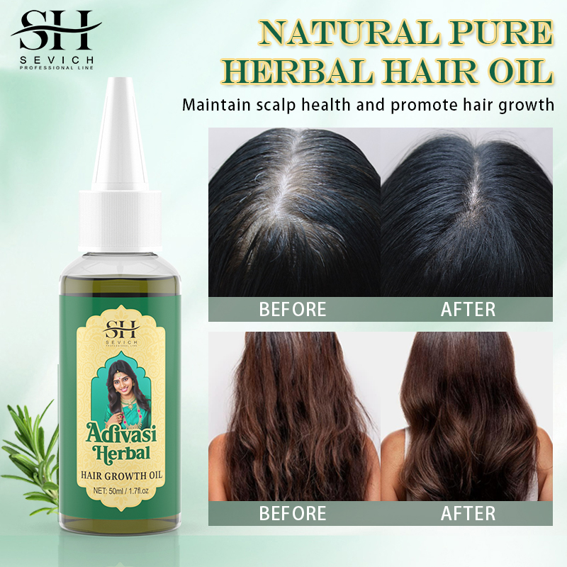 Ayurvedic Hair Growth Oil Adiv - Ayurvedic & Herbal Wellness Kits recension och pris