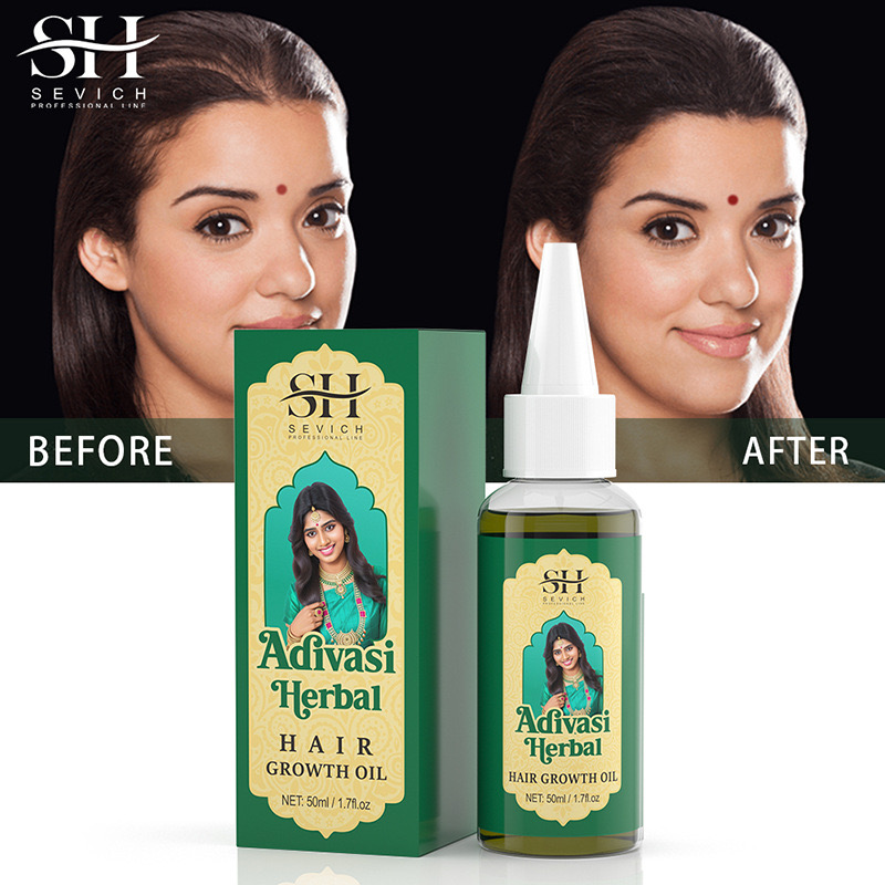 50ml Original India Oil Adivas - Ayurvedic & Herbal Wellness Kits recension och pris